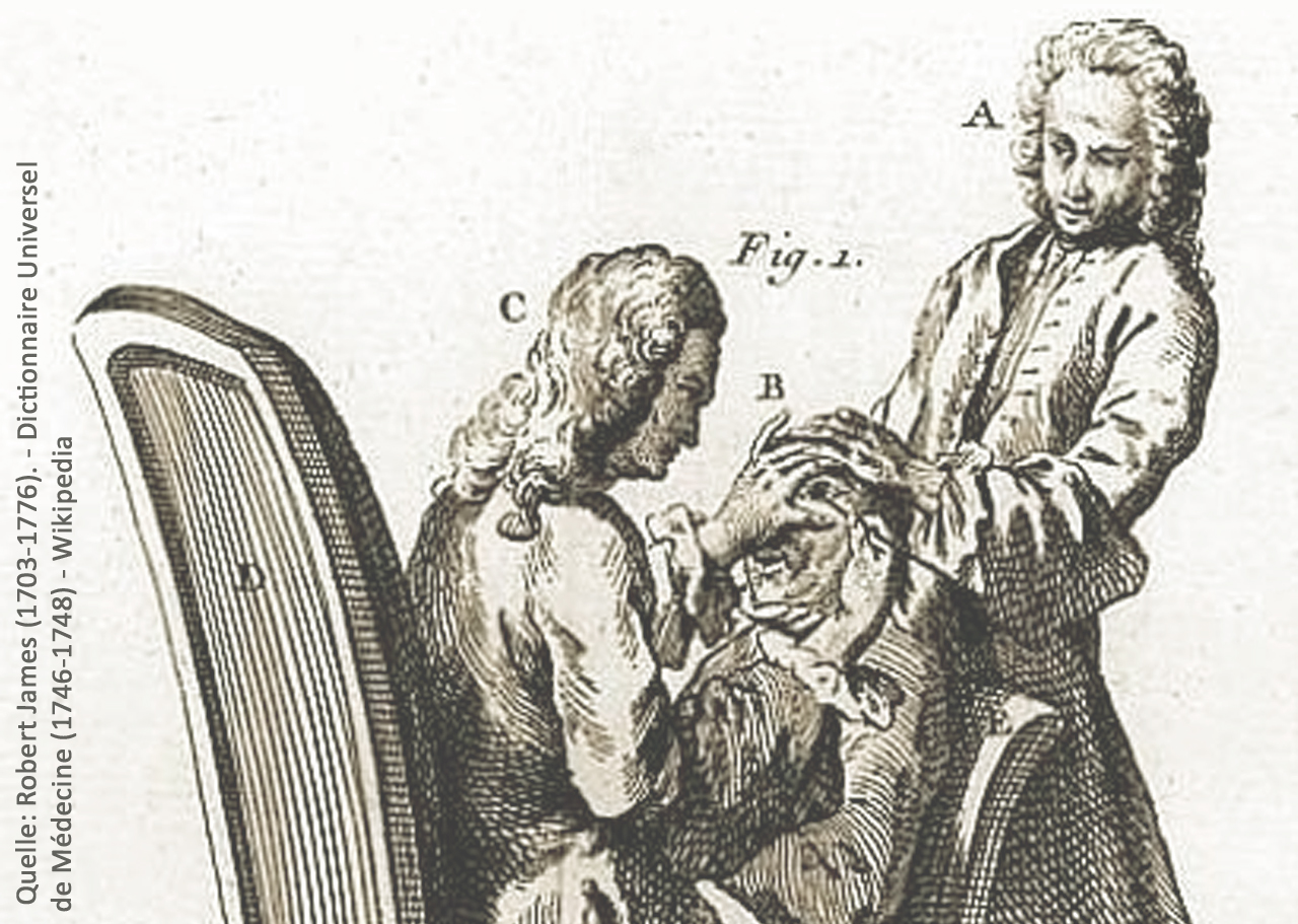 Die Geschichte der Augenheilkunde 9 Katarakt OP im Mittelalter Wikipedia