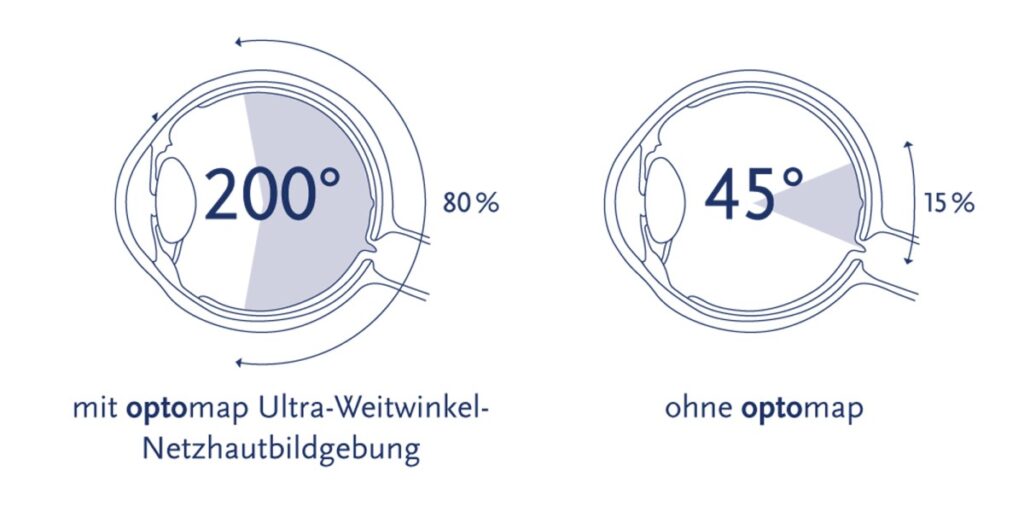 Moderne Netzhautdiagnostik – Mehr sehen. Früher erkennen. 1 Optomap Aufname Winkel