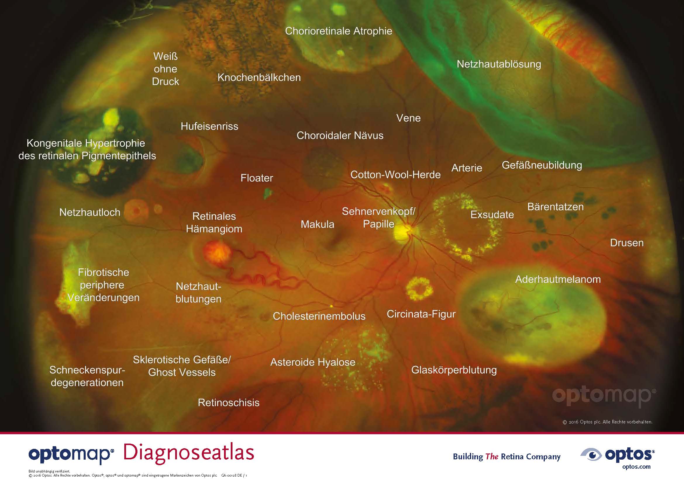 Moderne Netzhautdiagnostik – Mehr sehen. Früher erkennen. 3 optomap farb diagnoseatlas de